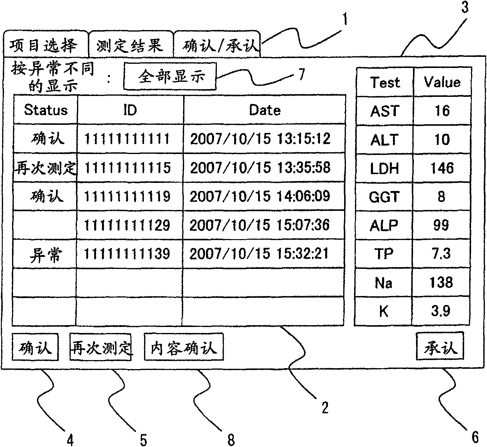 Automatic analyzer