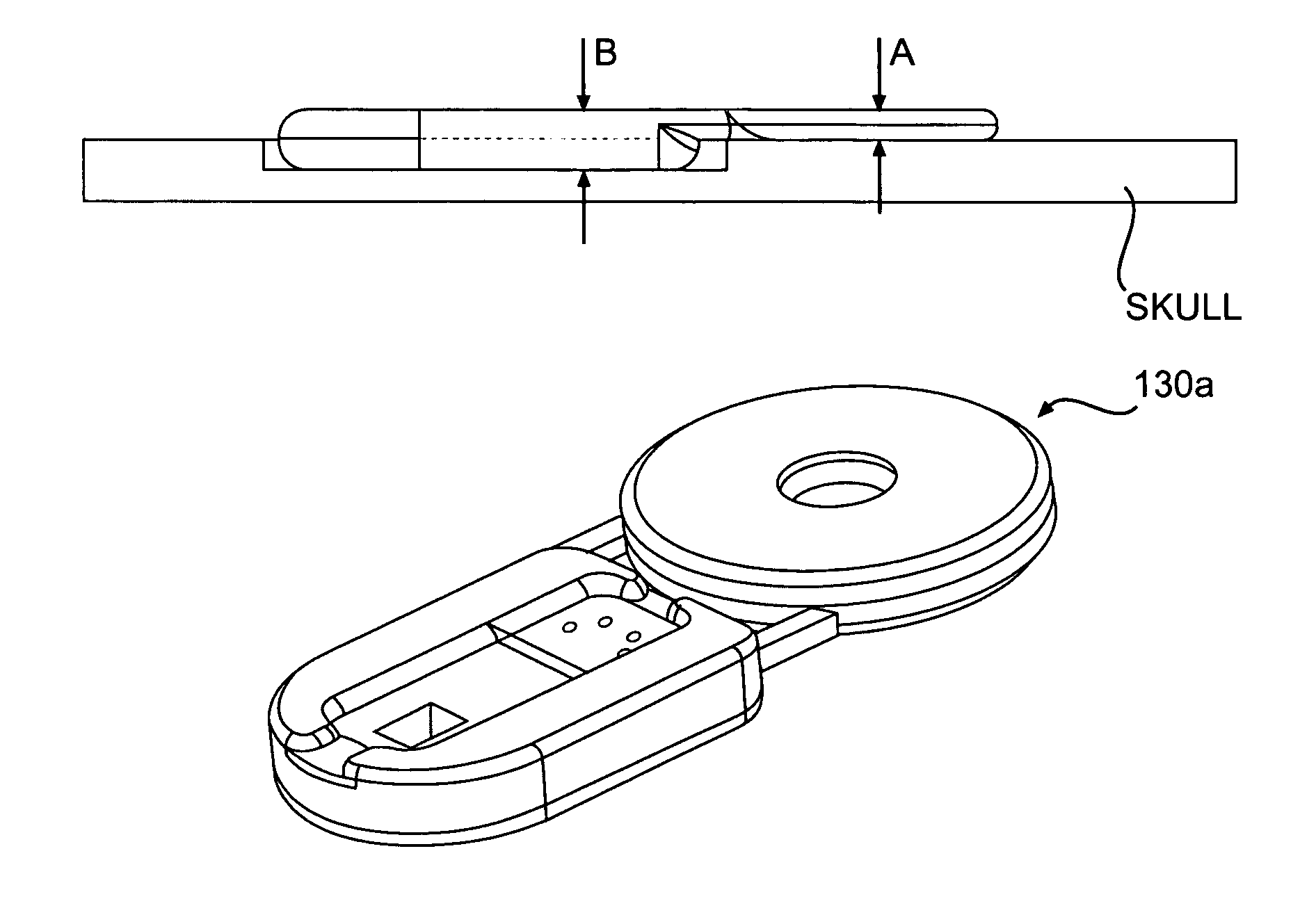 Biological interface system