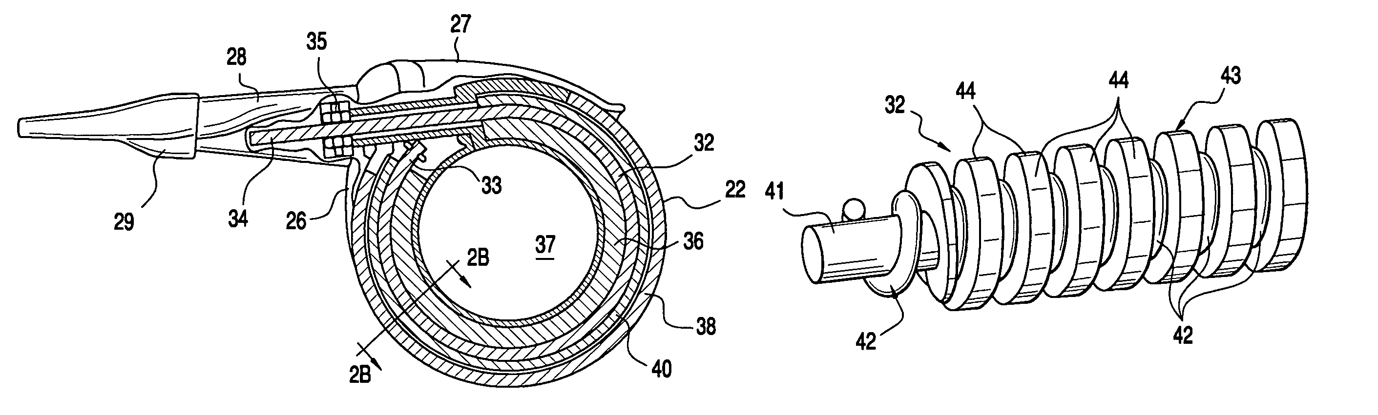 Telemetrically controlled band for regulating functioning of a body organ or duct, and methods of making, implantation and use