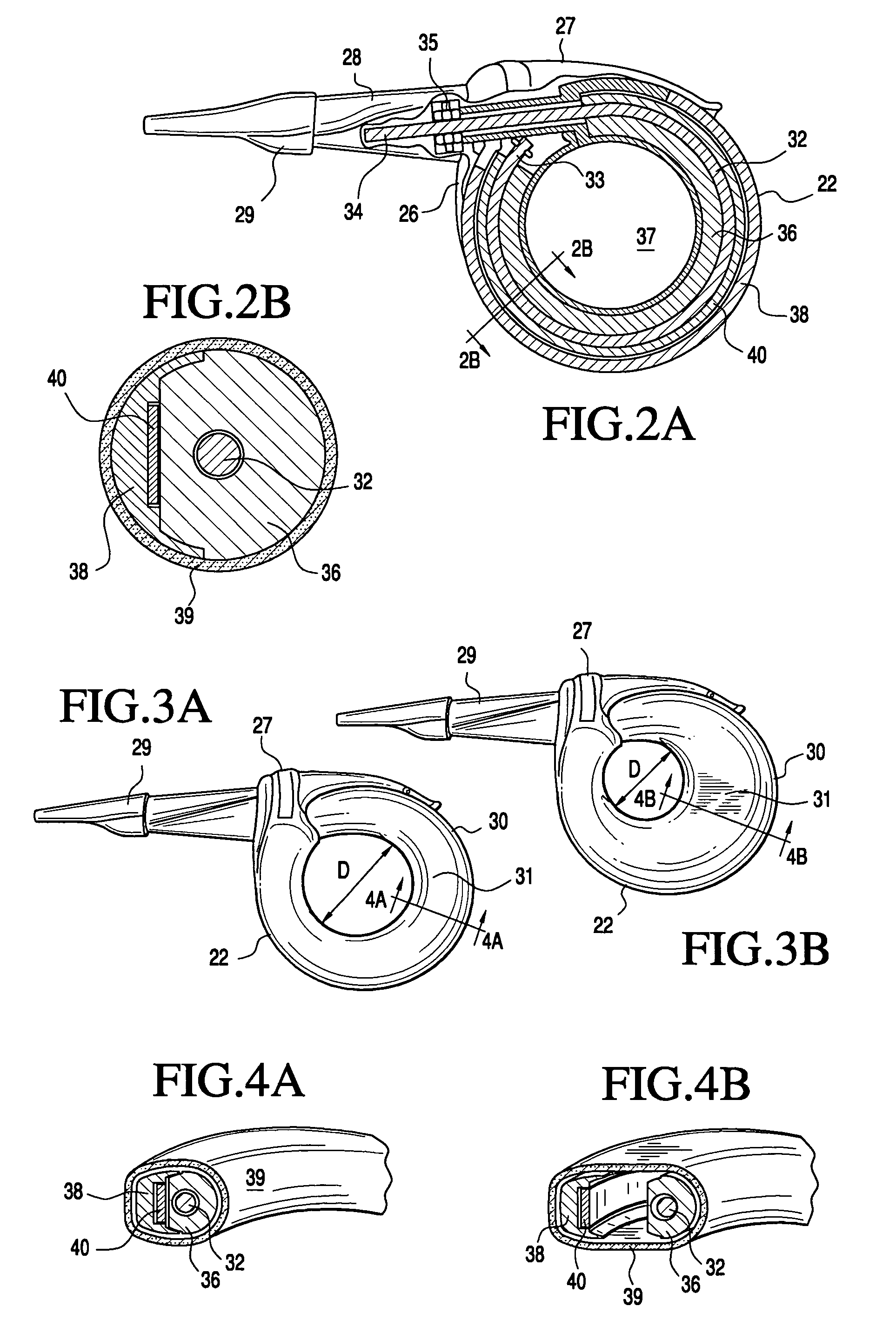 Telemetrically controlled band for regulating functioning of a body organ or duct, and methods of making, implantation and use