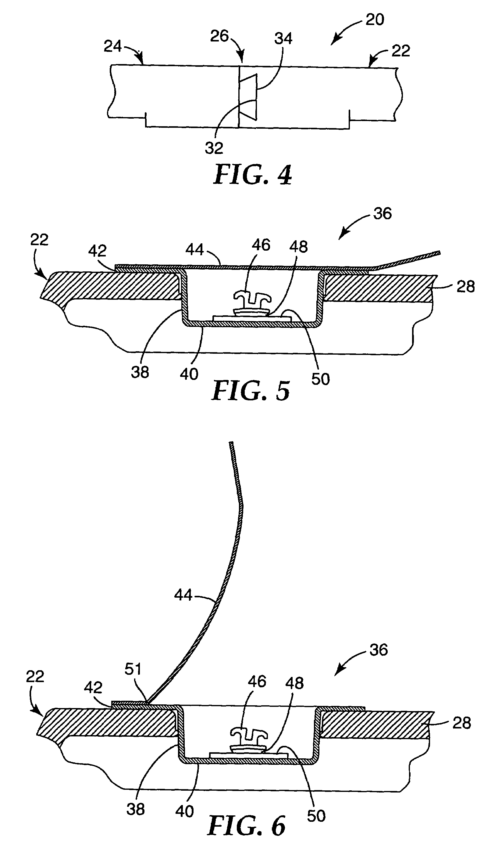 Orthodontic patient set-up tray