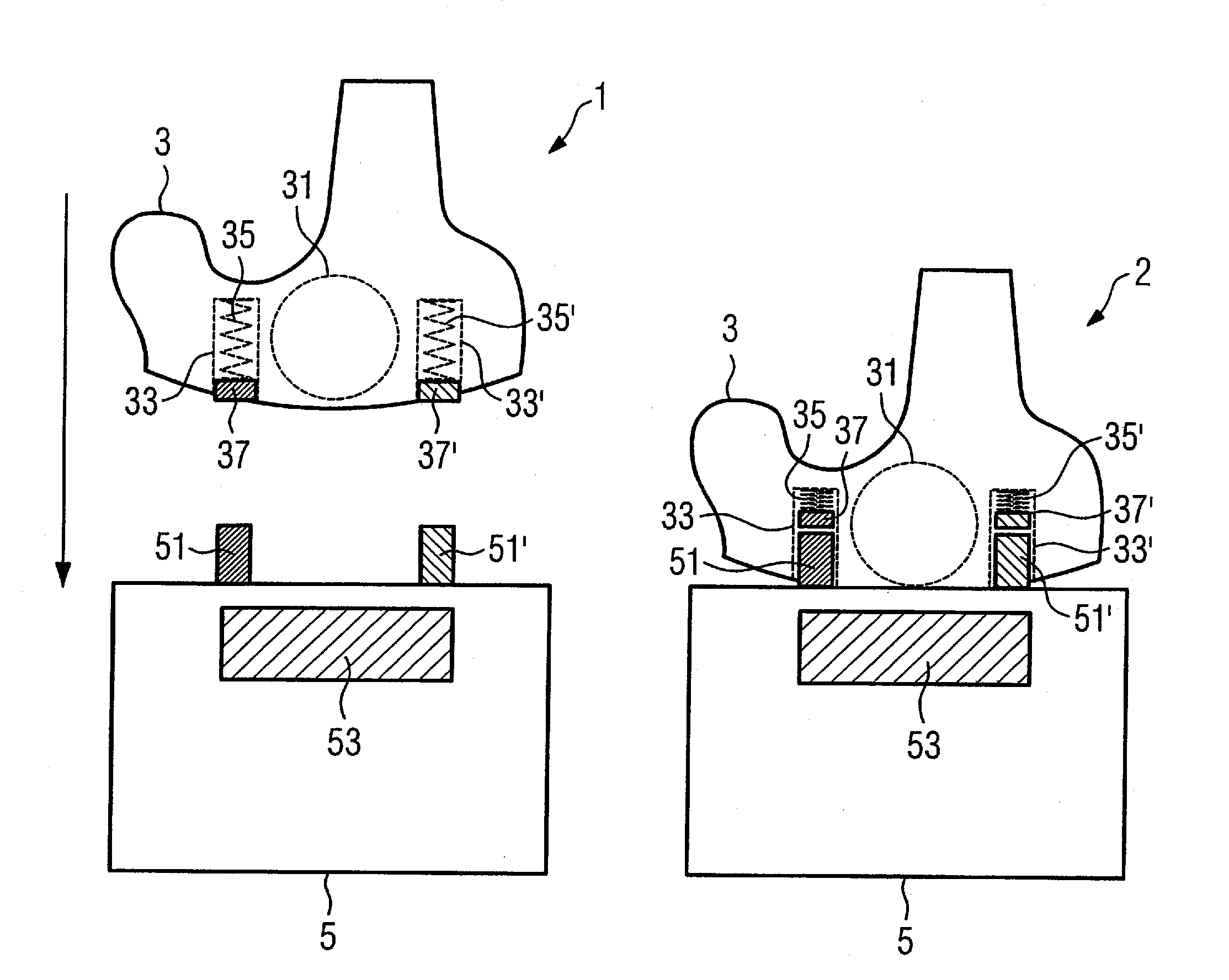 Hearing device with rechargeable battery and movably mounted charging contacts