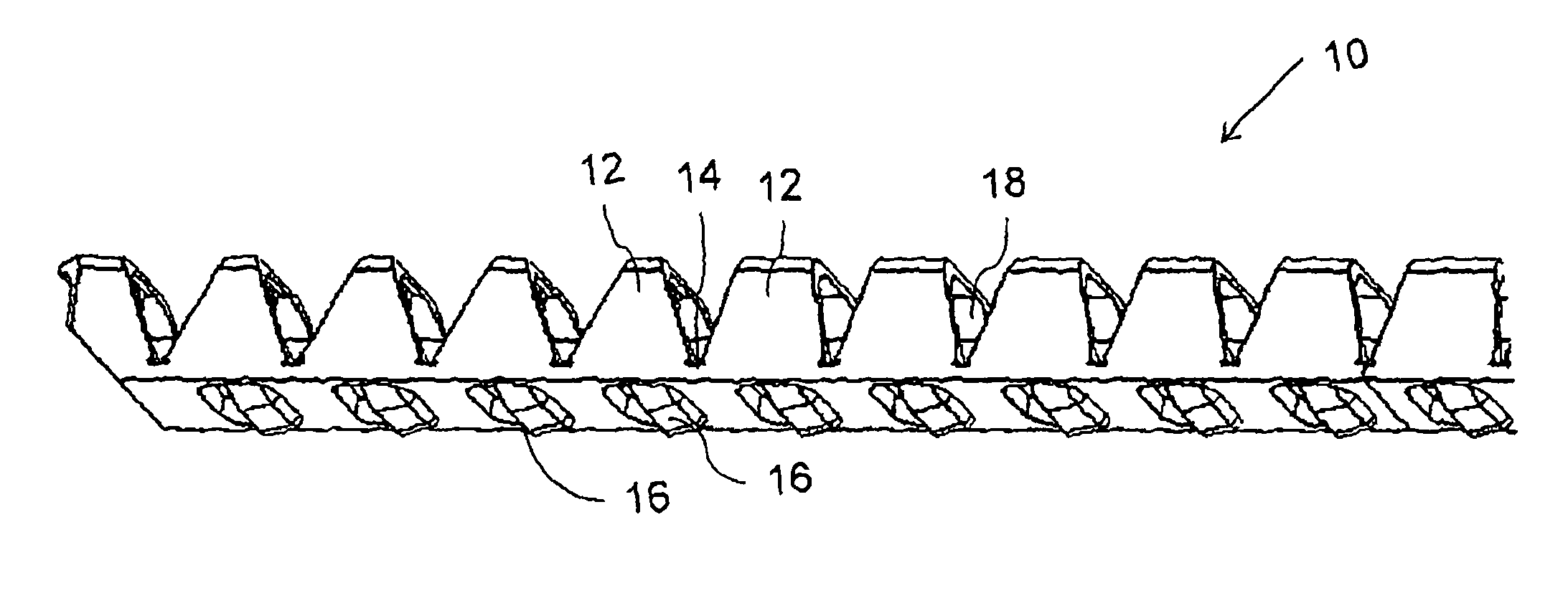 Tool and corresponding method for removal of material from within a body