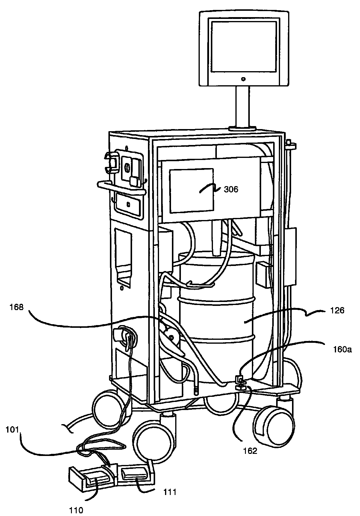 Cryosurgery system