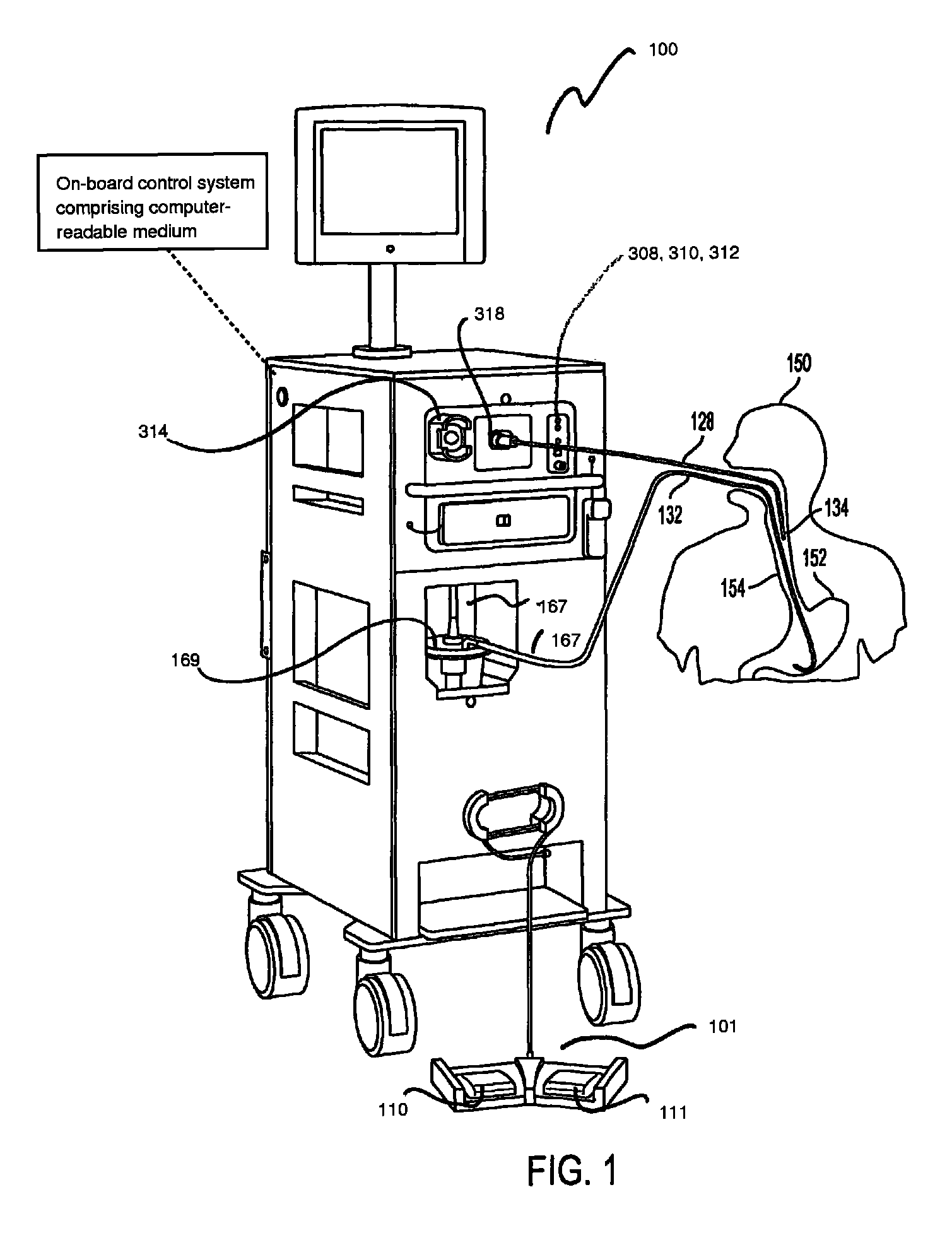 Cryosurgery system