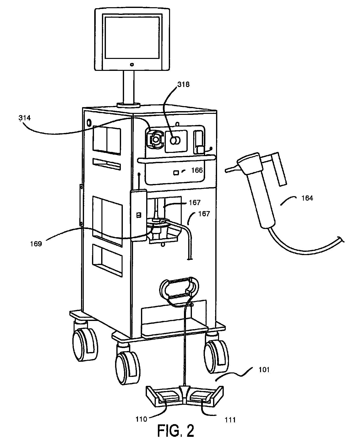 Cryosurgery system