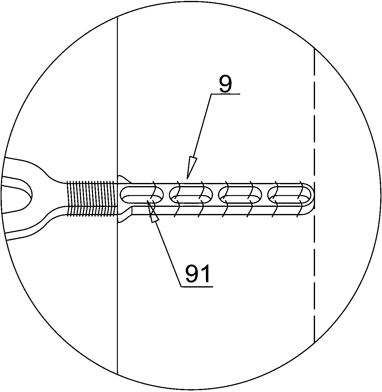 Thoracic aortic aneurysm coated stent and thoracic aortic aneurysm minimally invasive treatment system