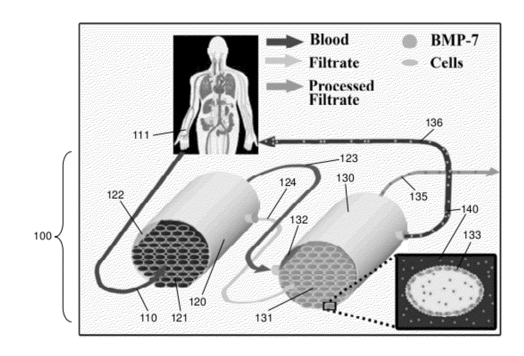 Double coating procedure for the membranes of bioartificial kidneys