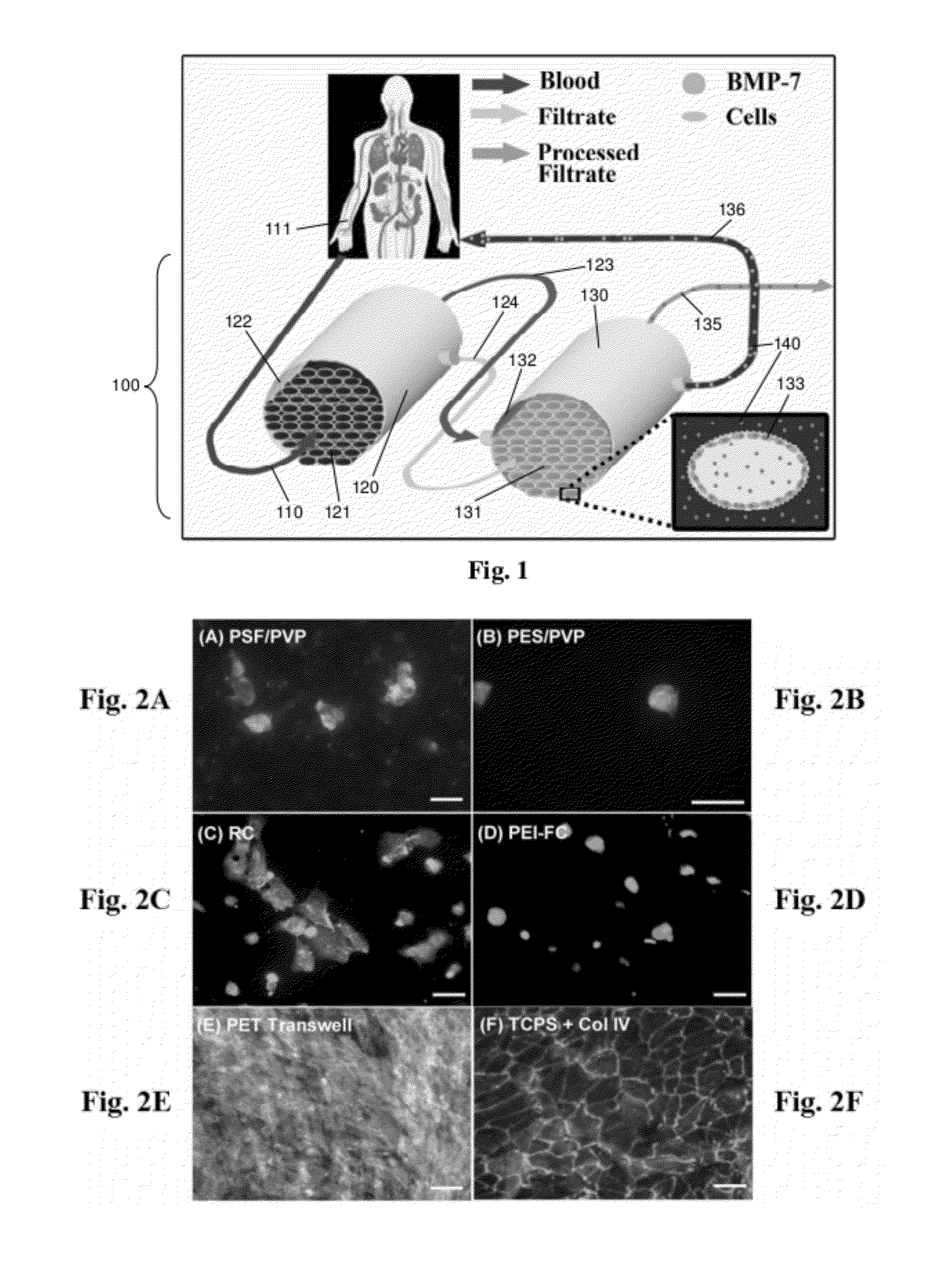 Double coating procedure for the membranes of bioartificial kidneys