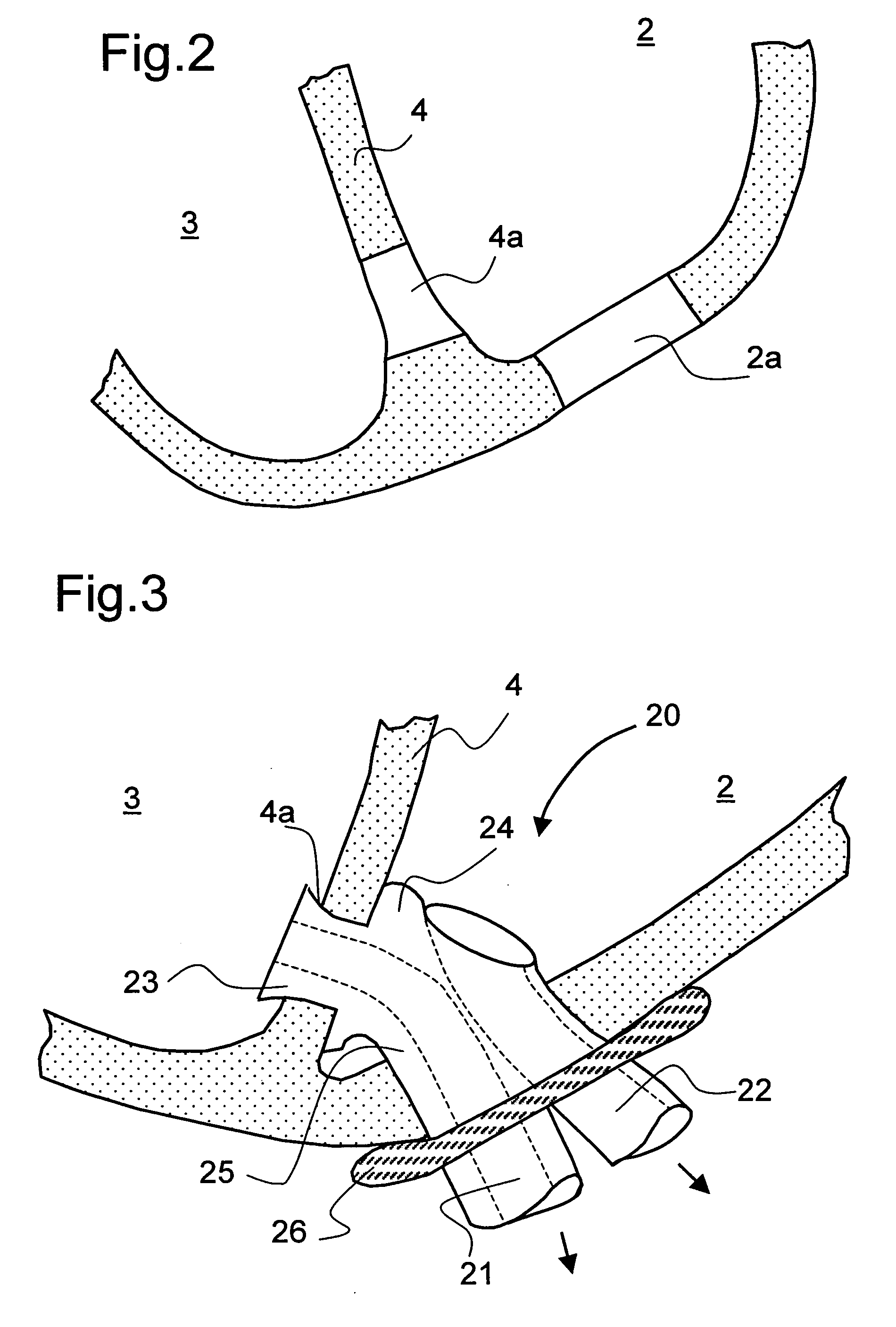 Device for connecting a cardiac biventricular assist means