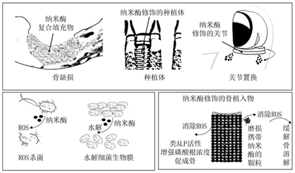 Bone implant material based on nano-enzyme drug modification and preparation method and application thereof