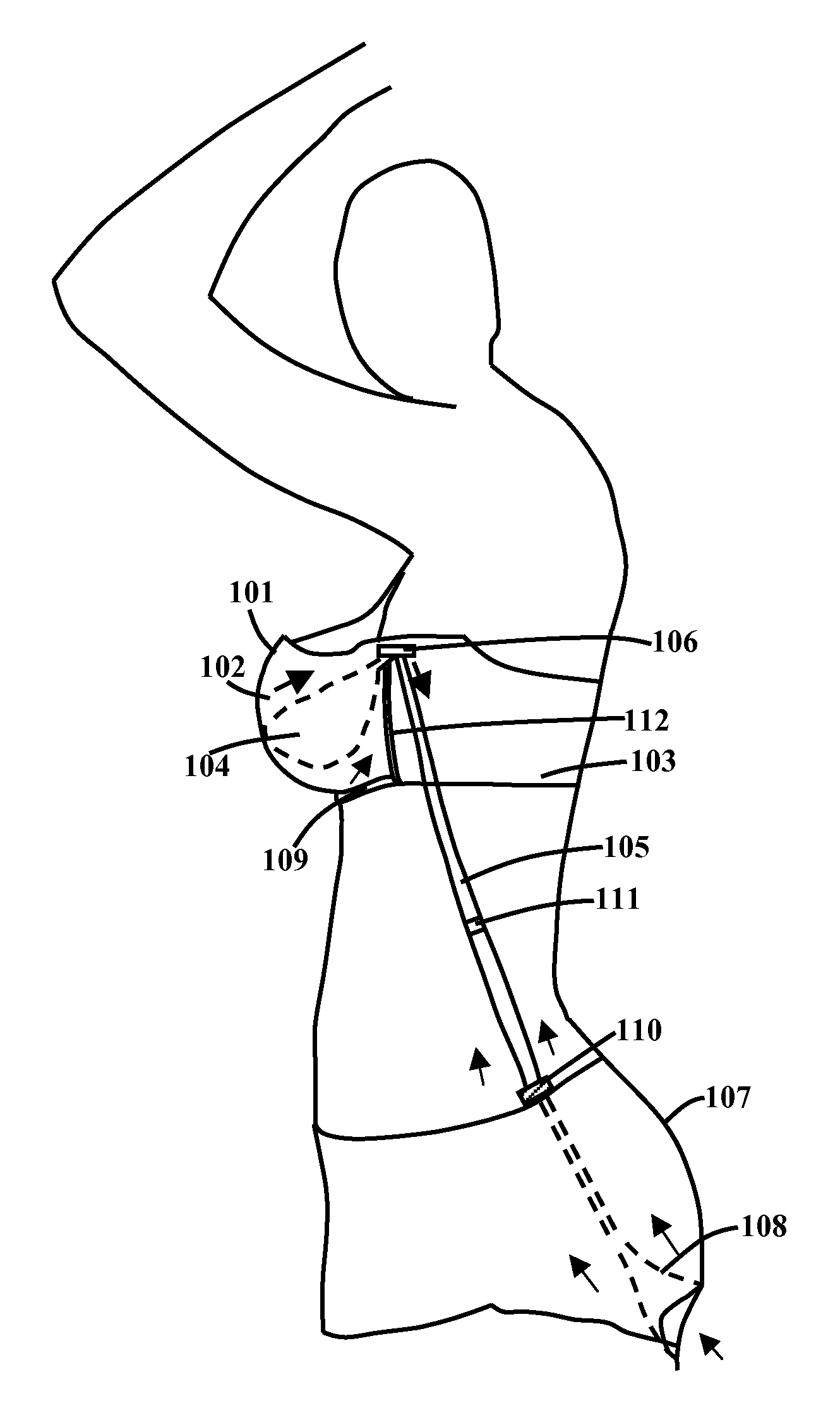 Undergarment with a weight suspension means