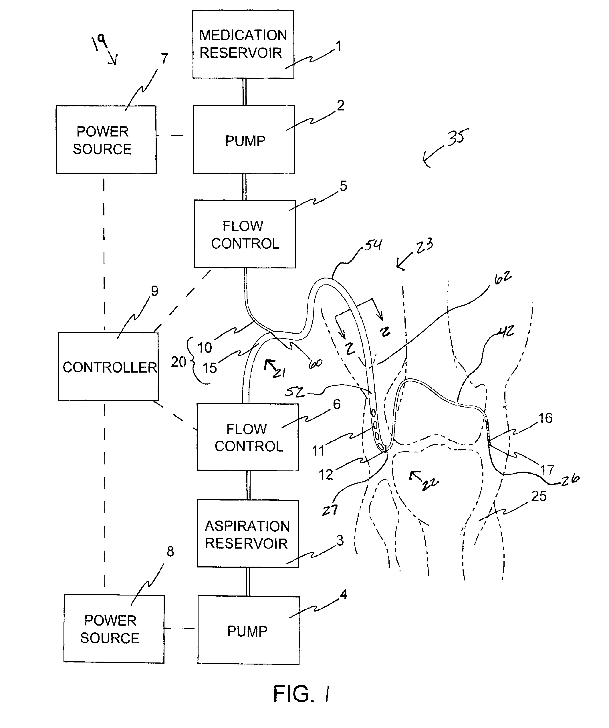 Integrated Infusion and Aspiration System and Method