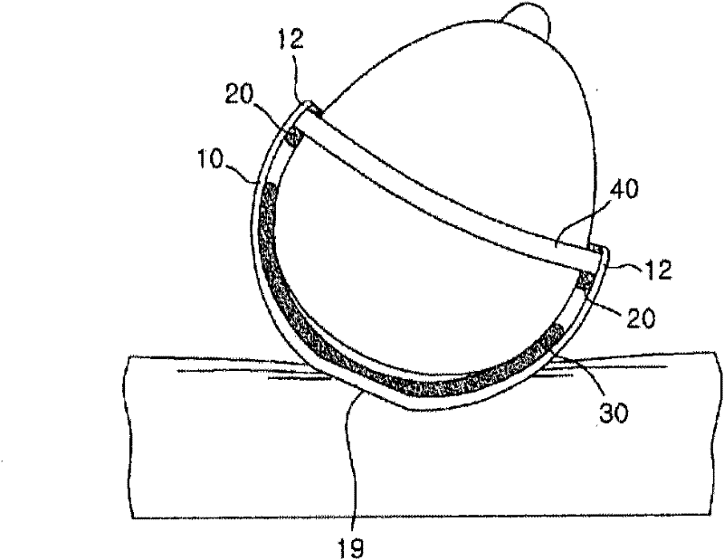 Head-shape remodelling instrument