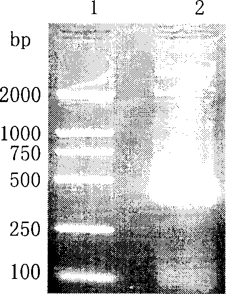 Fusion protein of tetanus toxin T cell expressing bit polypeptide and human bata lymph cell stimulating factor and preparing thereof