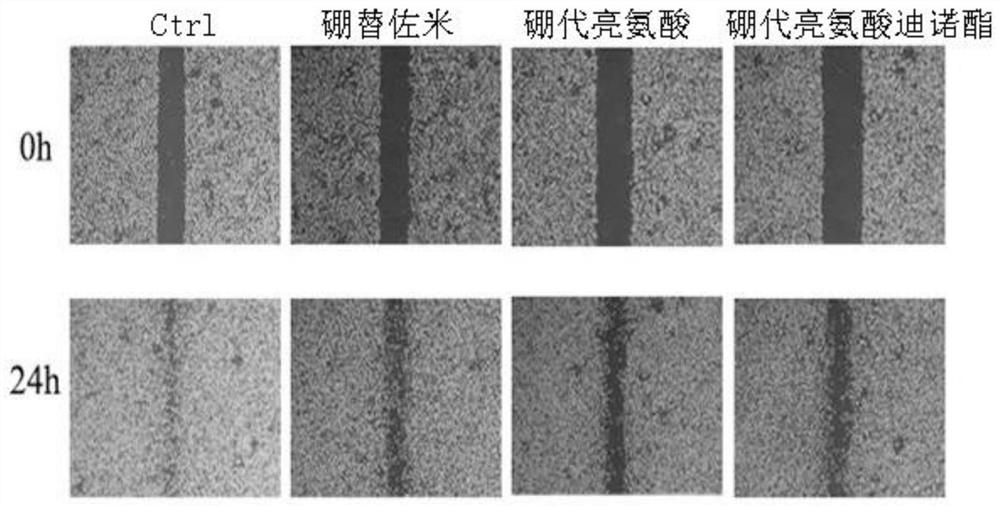 New application of boron-substituted leucine compound