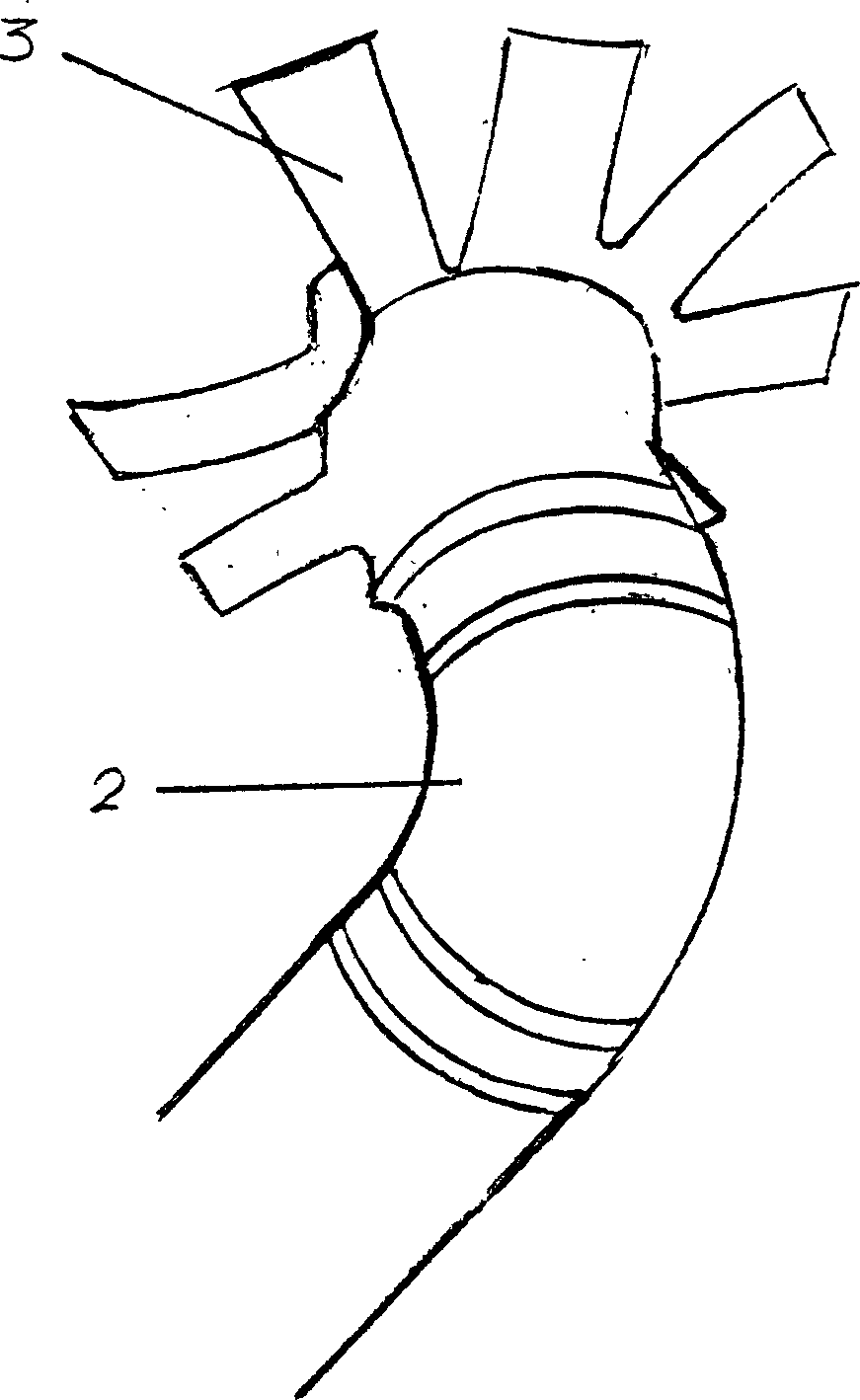 Unidirectional heat conduction apparatus