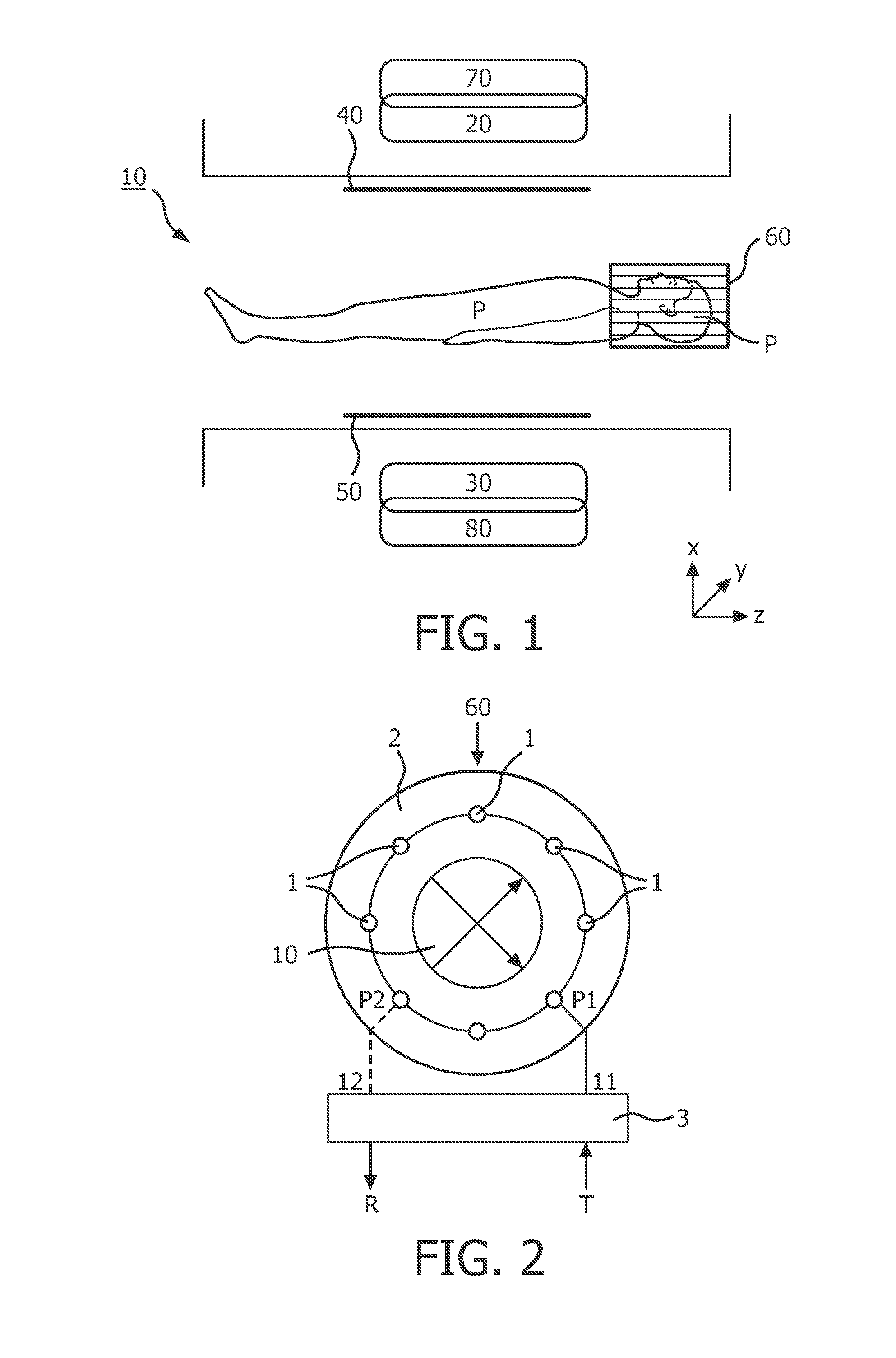 Multichannel RF volume resonator for MRI