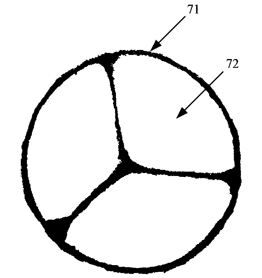 Intraesophageal stent used for esophageal rupture and stomal leak plugging