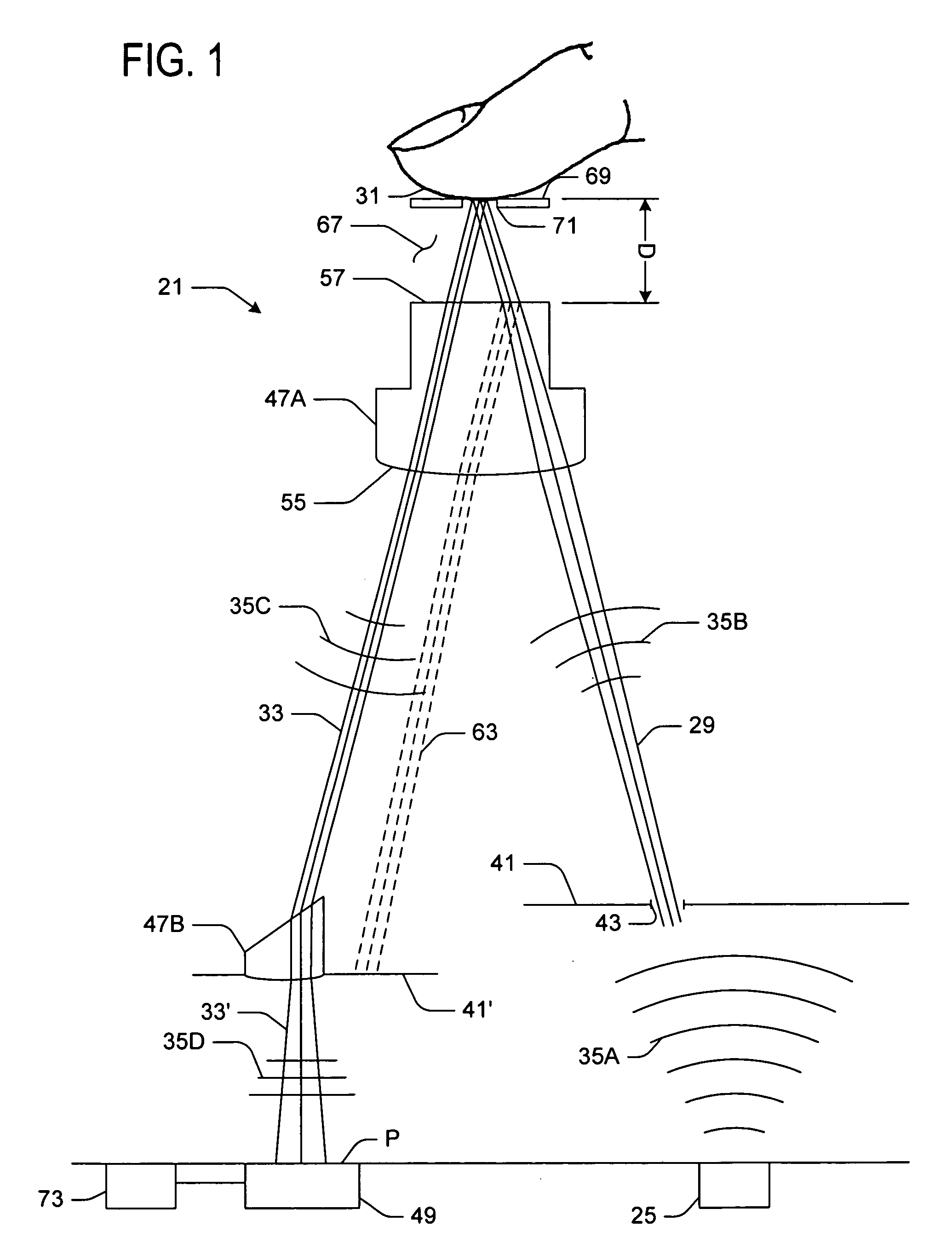 Data input devices and methods for detecting movement of a tracking surface by a laser speckle pattern