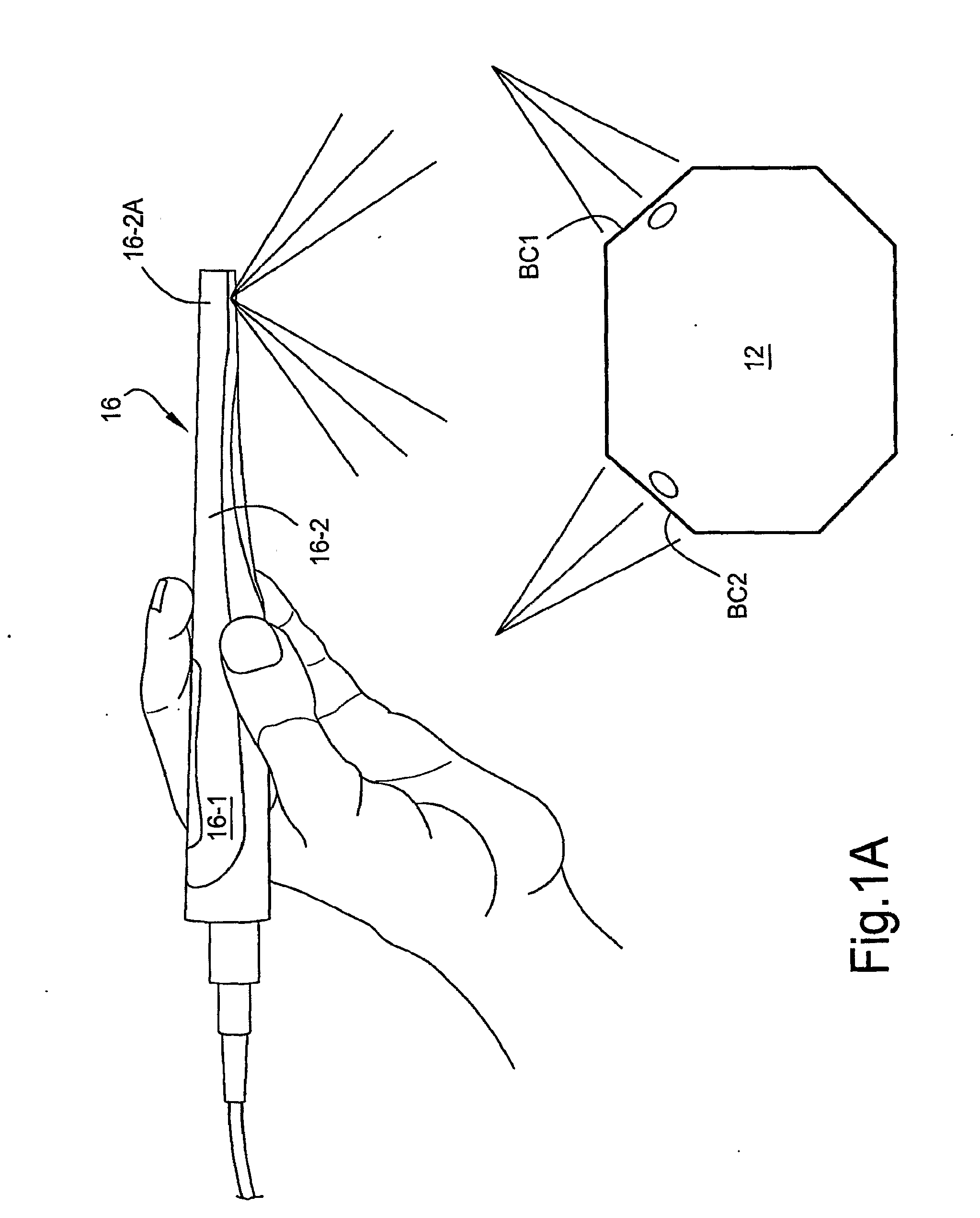 Force-responsive orthodontic brackets and systems and methods which use the same