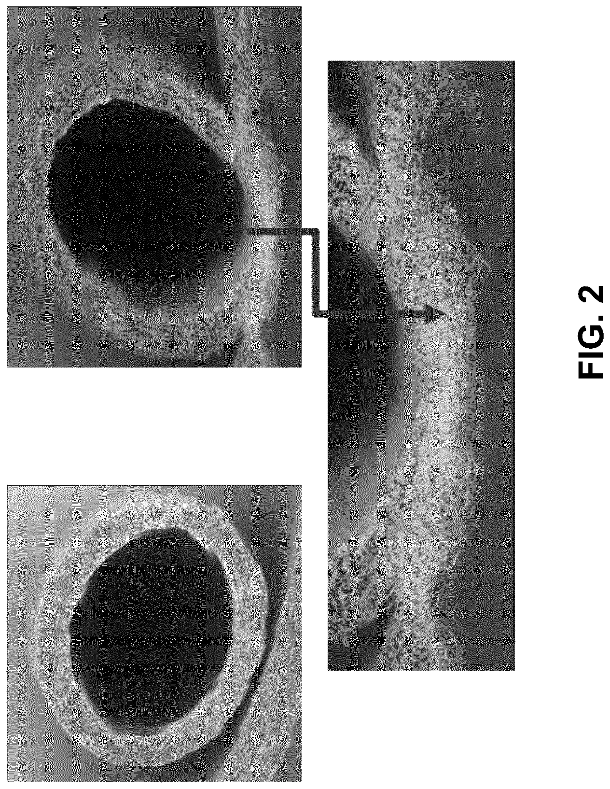 Electrospun polymer assemblies for medical implant applications