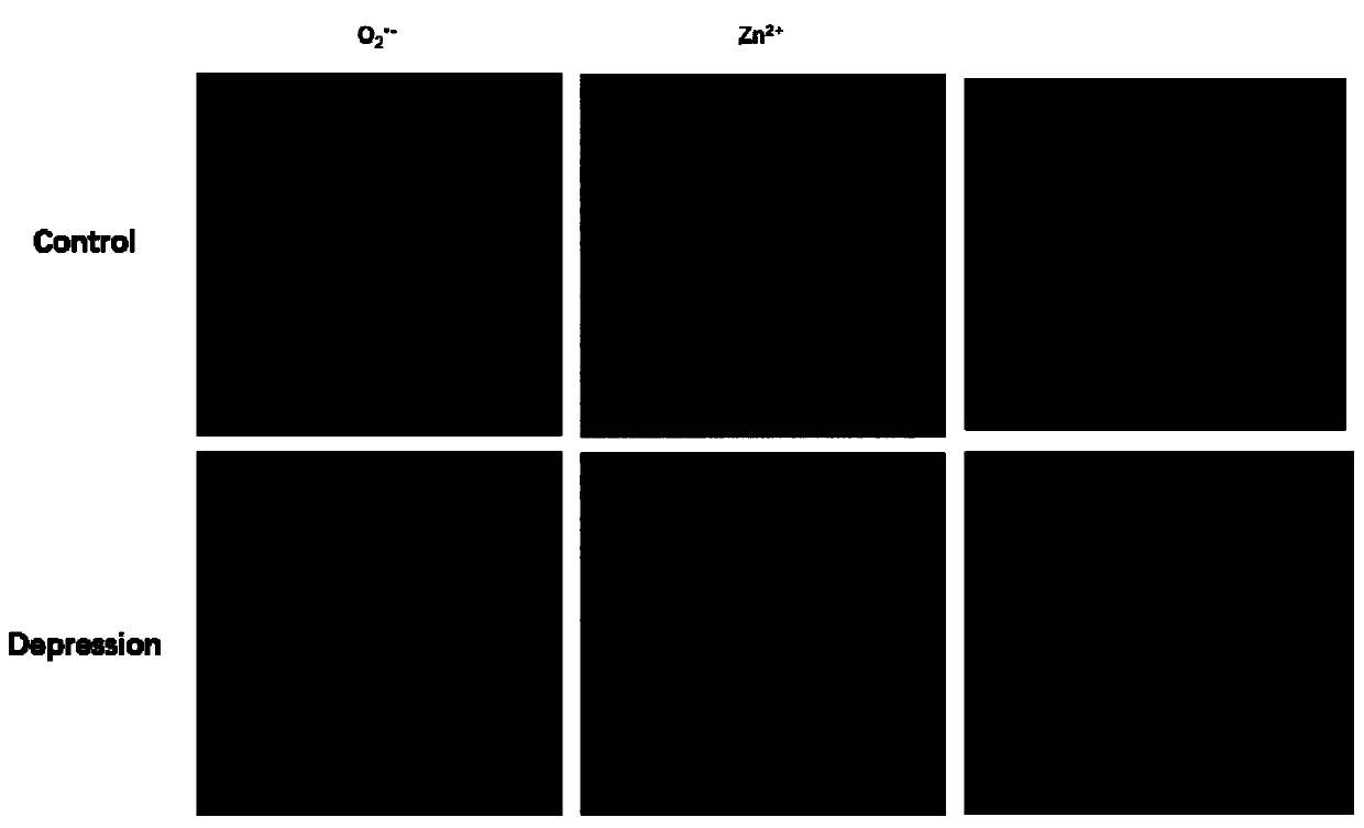 Double-color fluorescent probe as well as synthesis method and application thereof