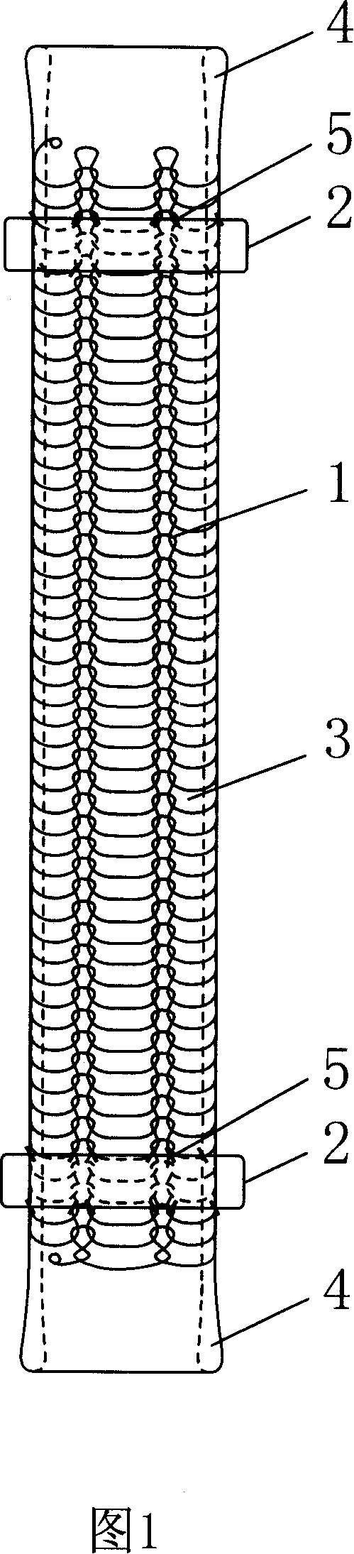 Artificial human body intracavity duct with buffer edge