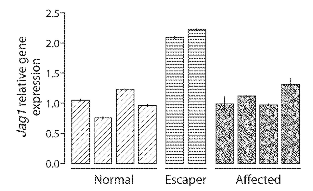 Compositions and methods of treating muscular dystrophy