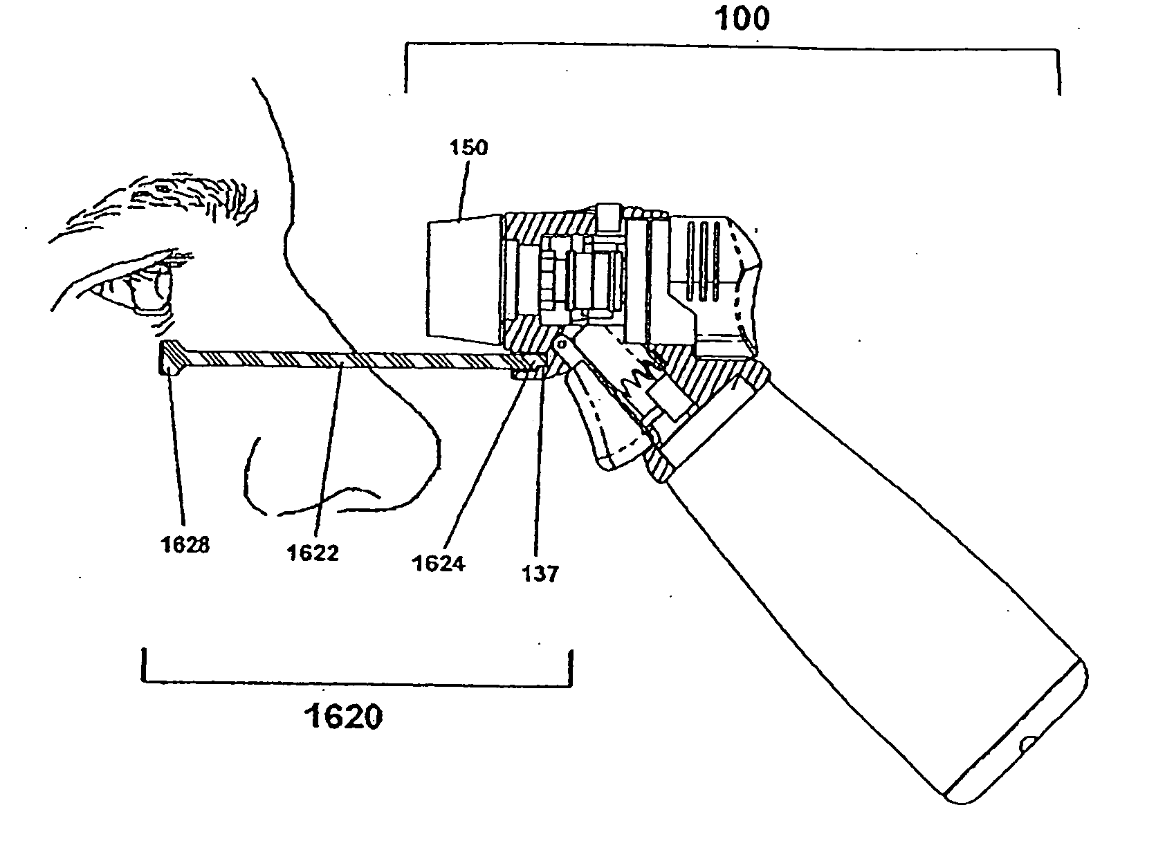 Ophthalmic fluid delivery system