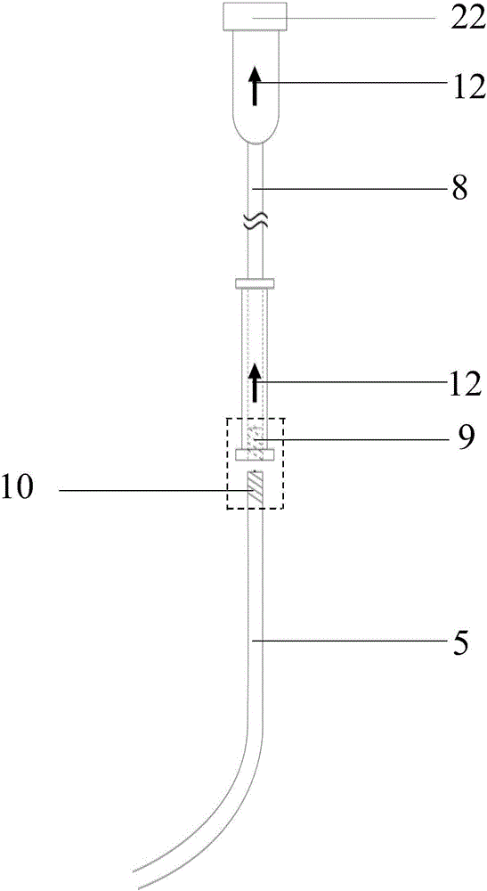 Special-shaped side branch balloon stent system for bifurcation lesion interventional therapy