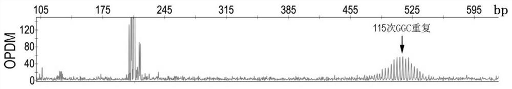 Oculopharyngodistal myopathy biomarker and detection method and use thereof