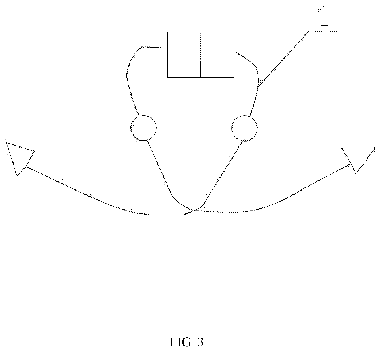 Novel incision-free adaptive tvt-xo for treatment of urinary incontinence