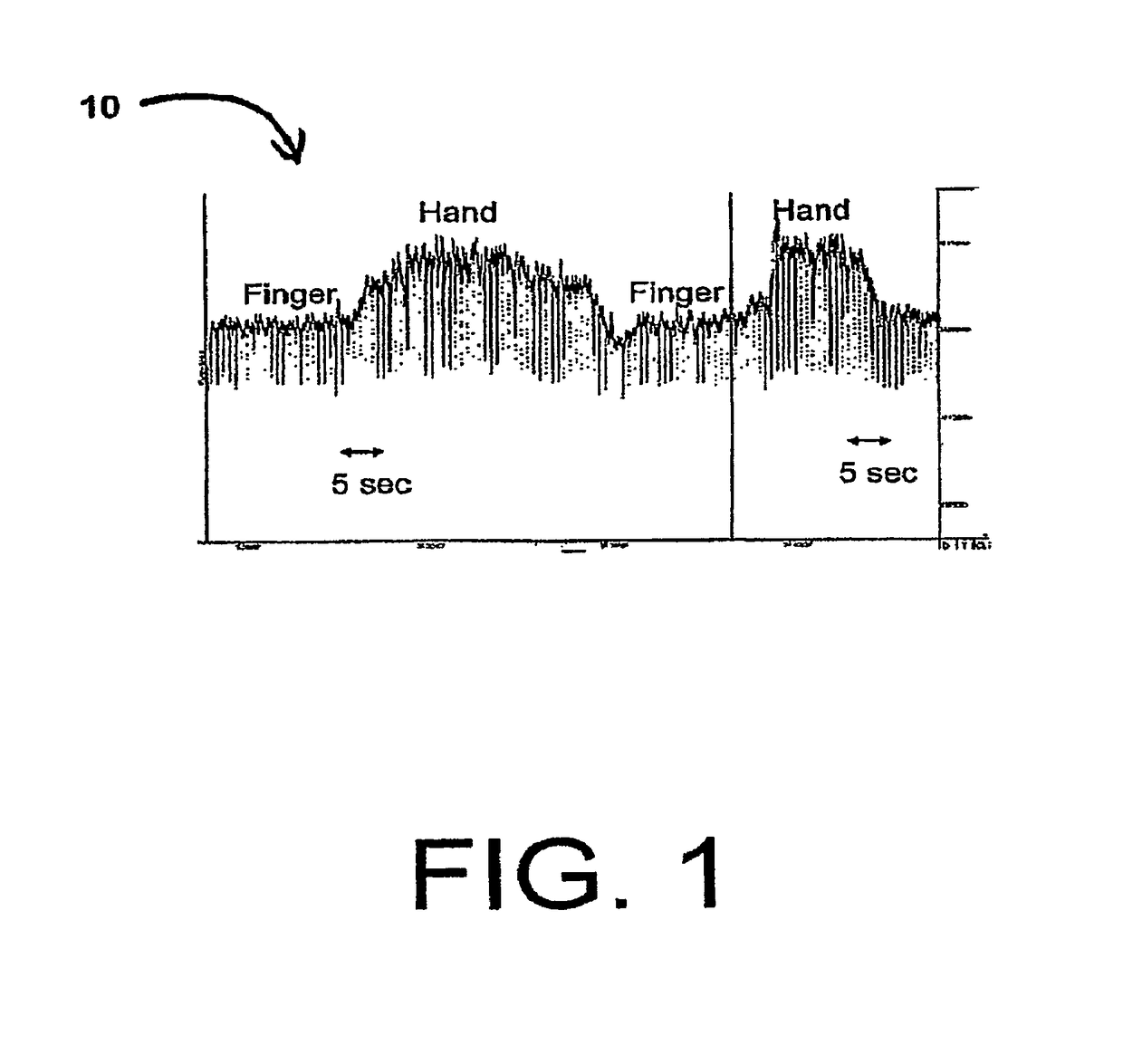 Body lumen junction localization