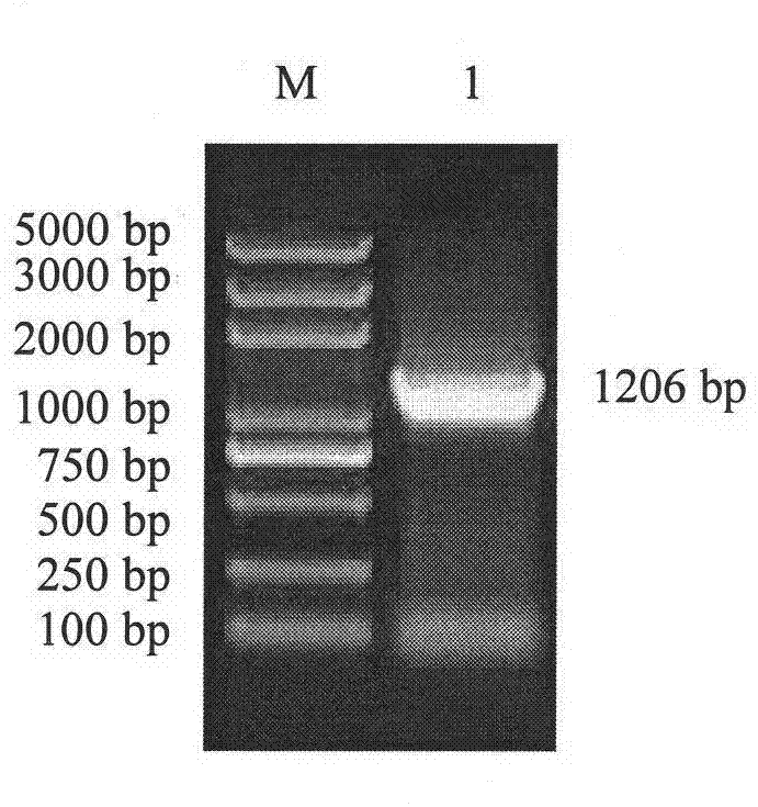 Fusion protein for resisting chicken coccidiosis, preparation and application thereof