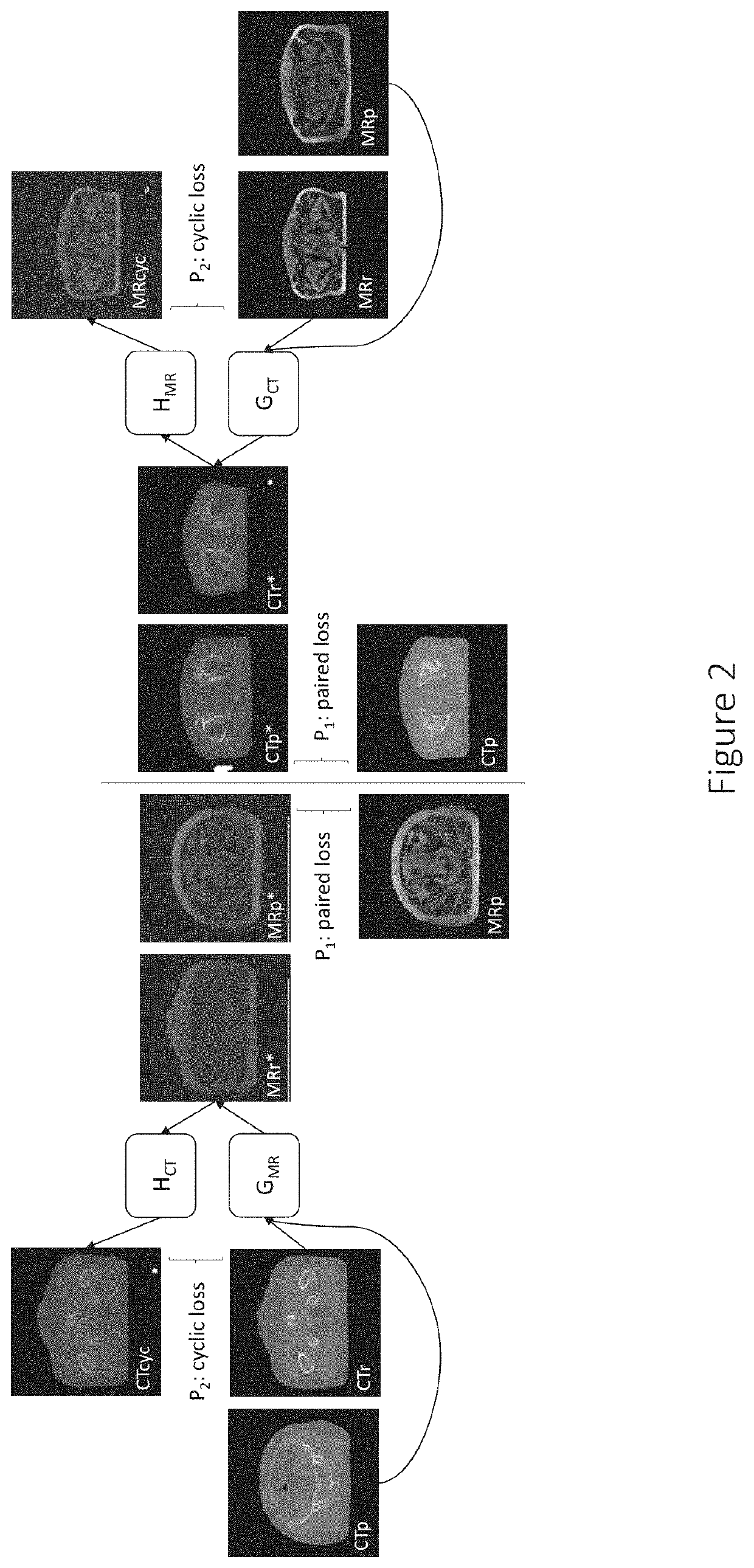 Medical image conversion