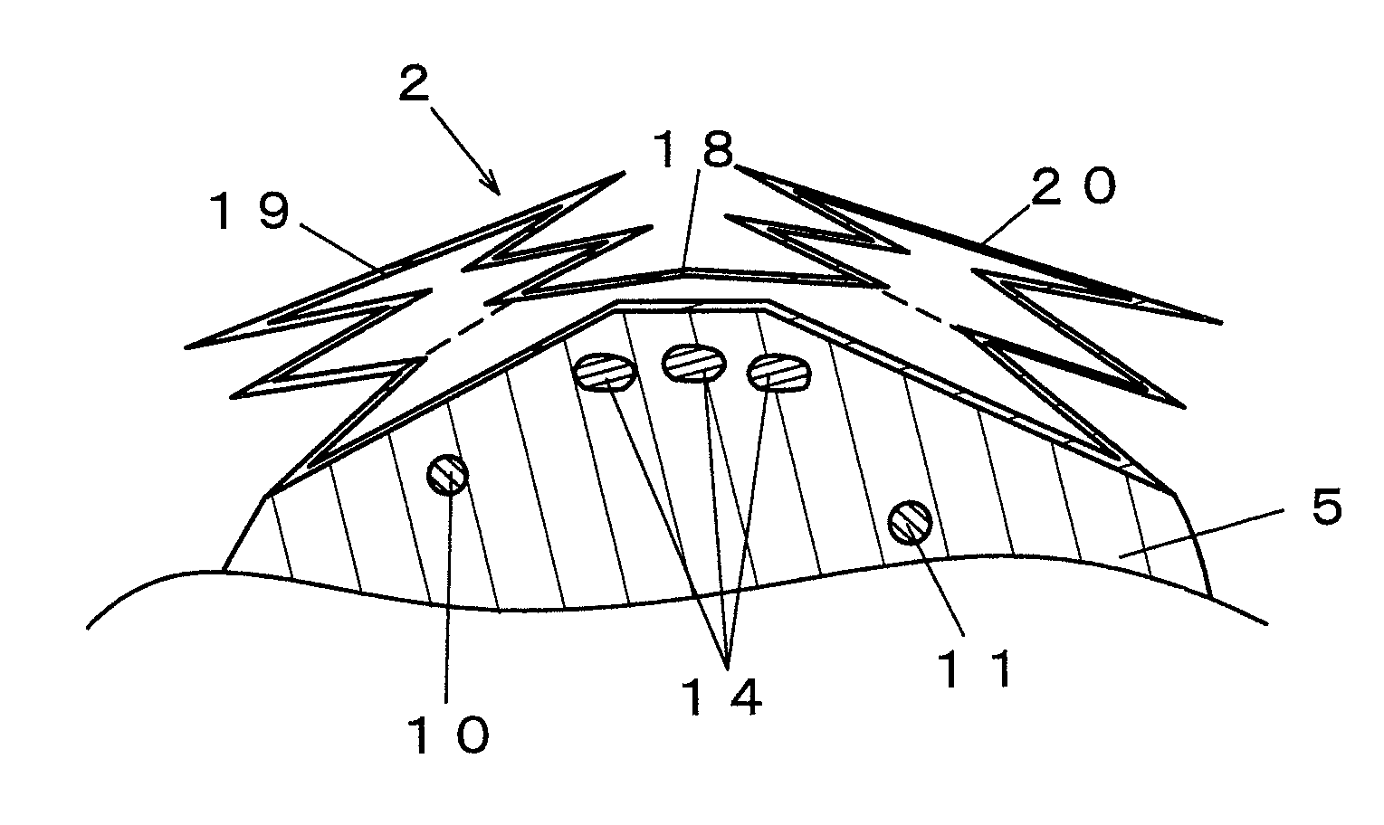 Living body information measuring apparatus