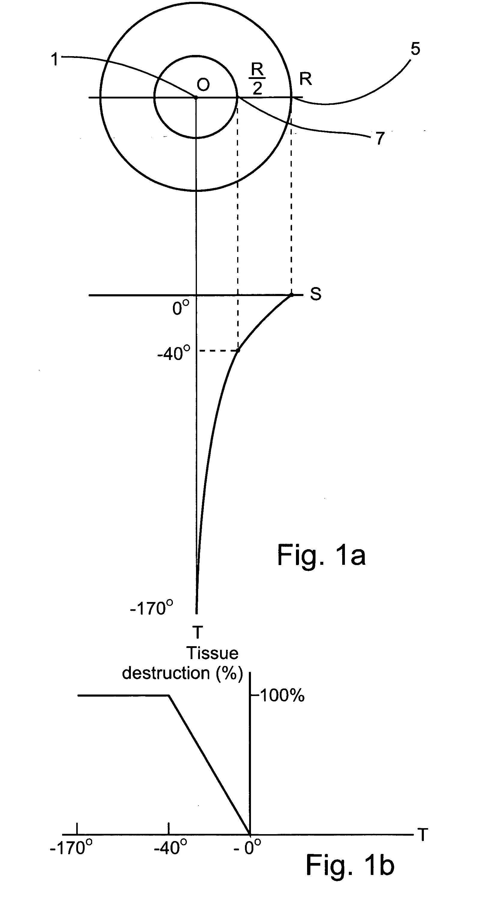 Planning and facilitation systems and methods for cryosurgery