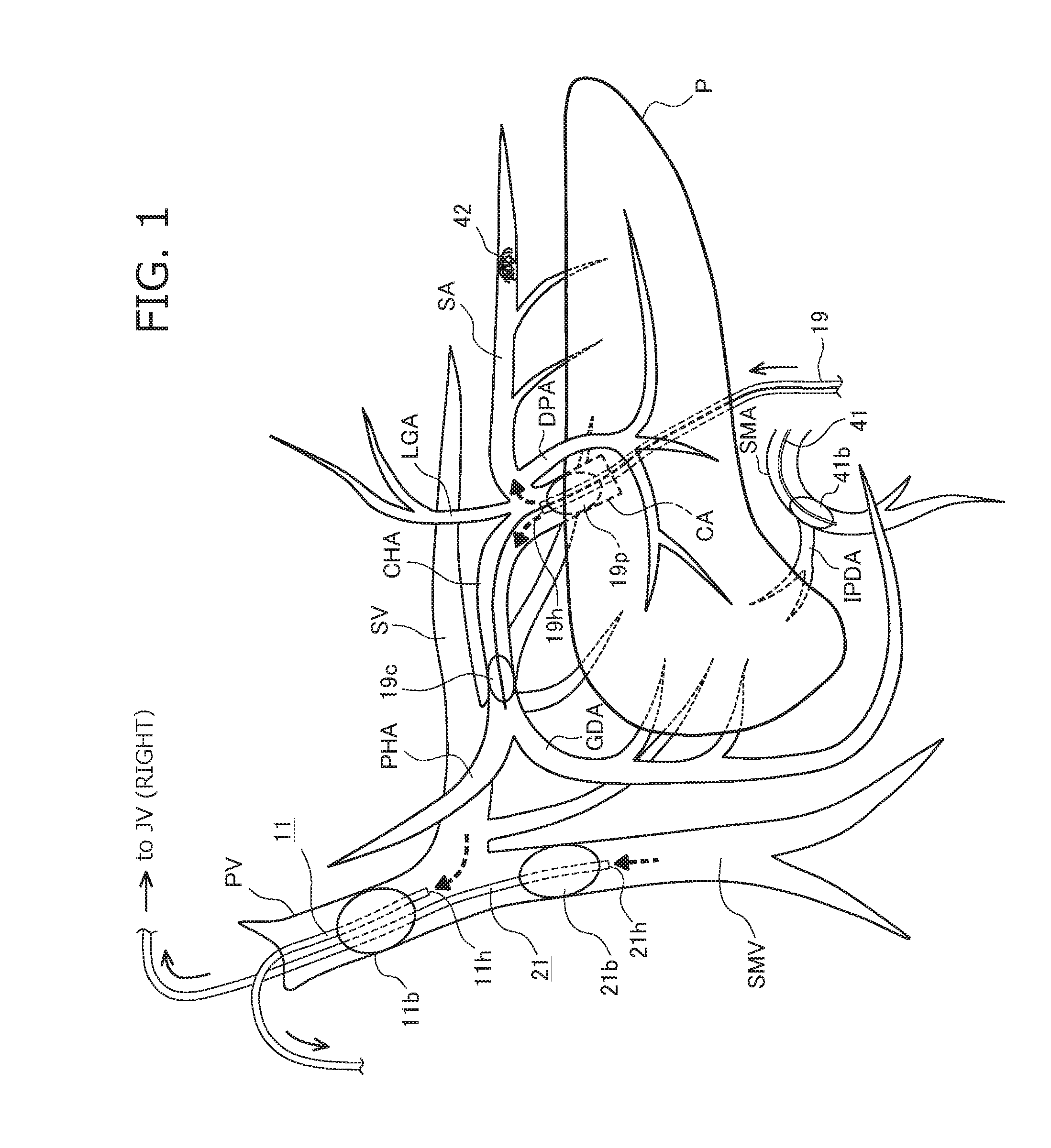 Pancreas perfusion device, method for controlling same, and method for pancreas perfusion