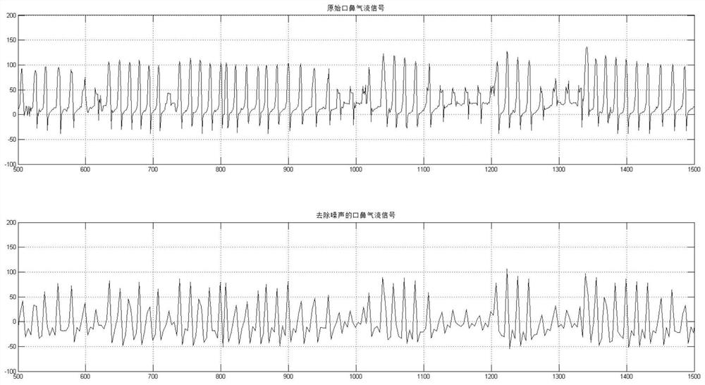 Chronic obstructive pulmonary disease recognition device based on mouth-nose airflow signal