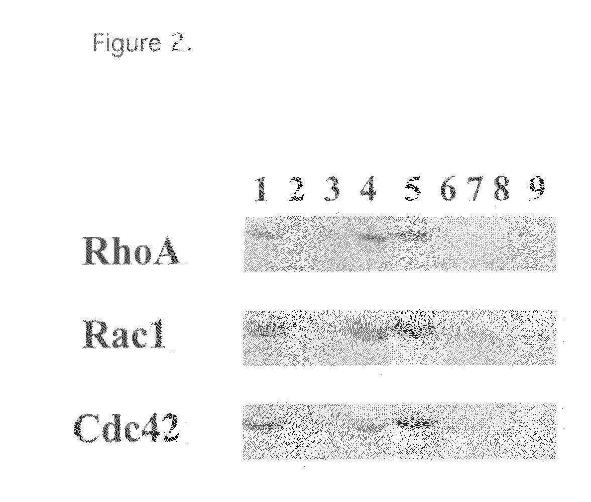 Mutants of clostridium difficile toxin B and methods of use