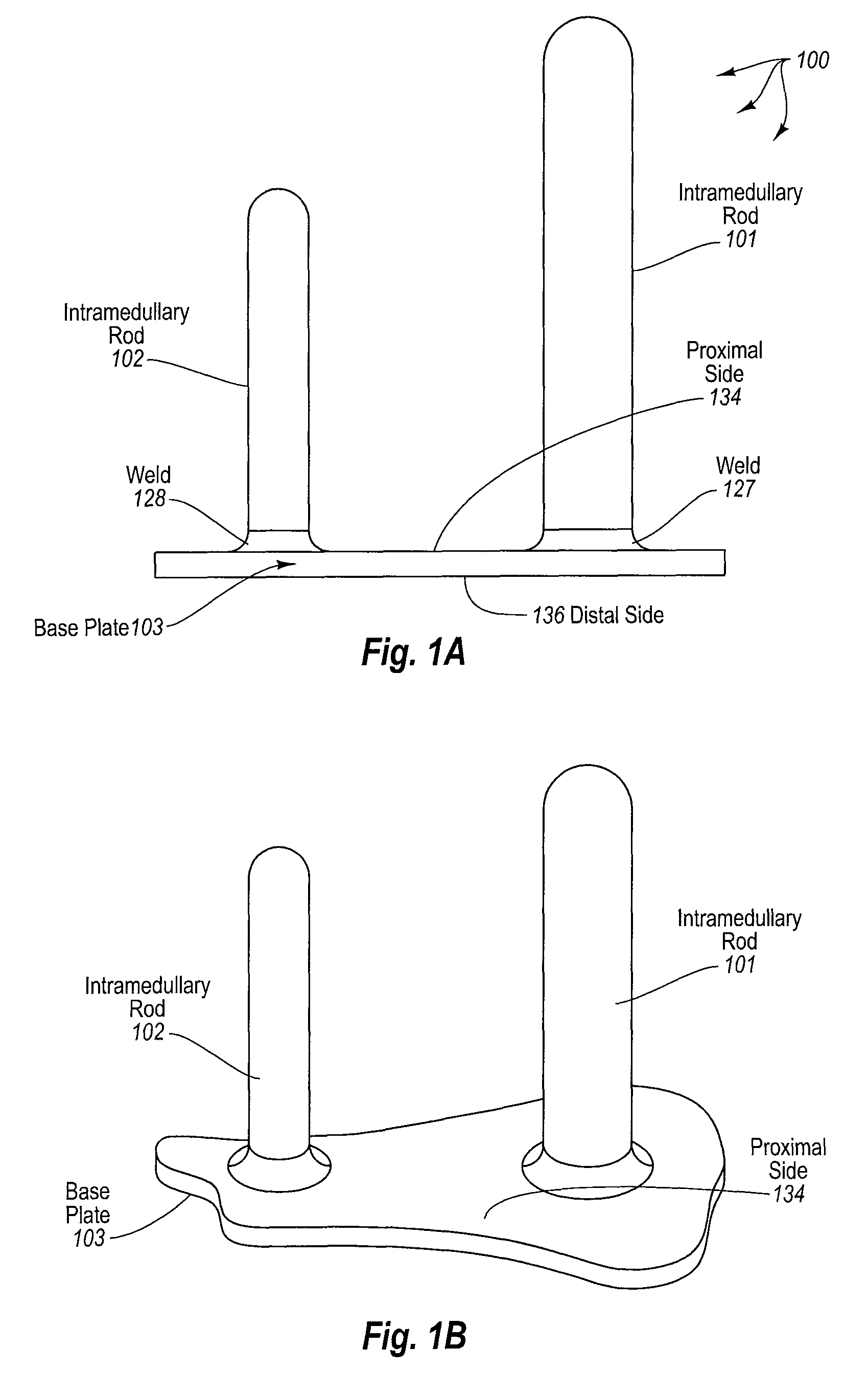 Amputation stabilization device