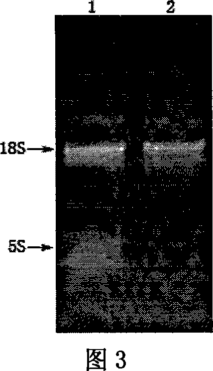 East-Asia scorpion antibiotic peptide gene and preparation method and application