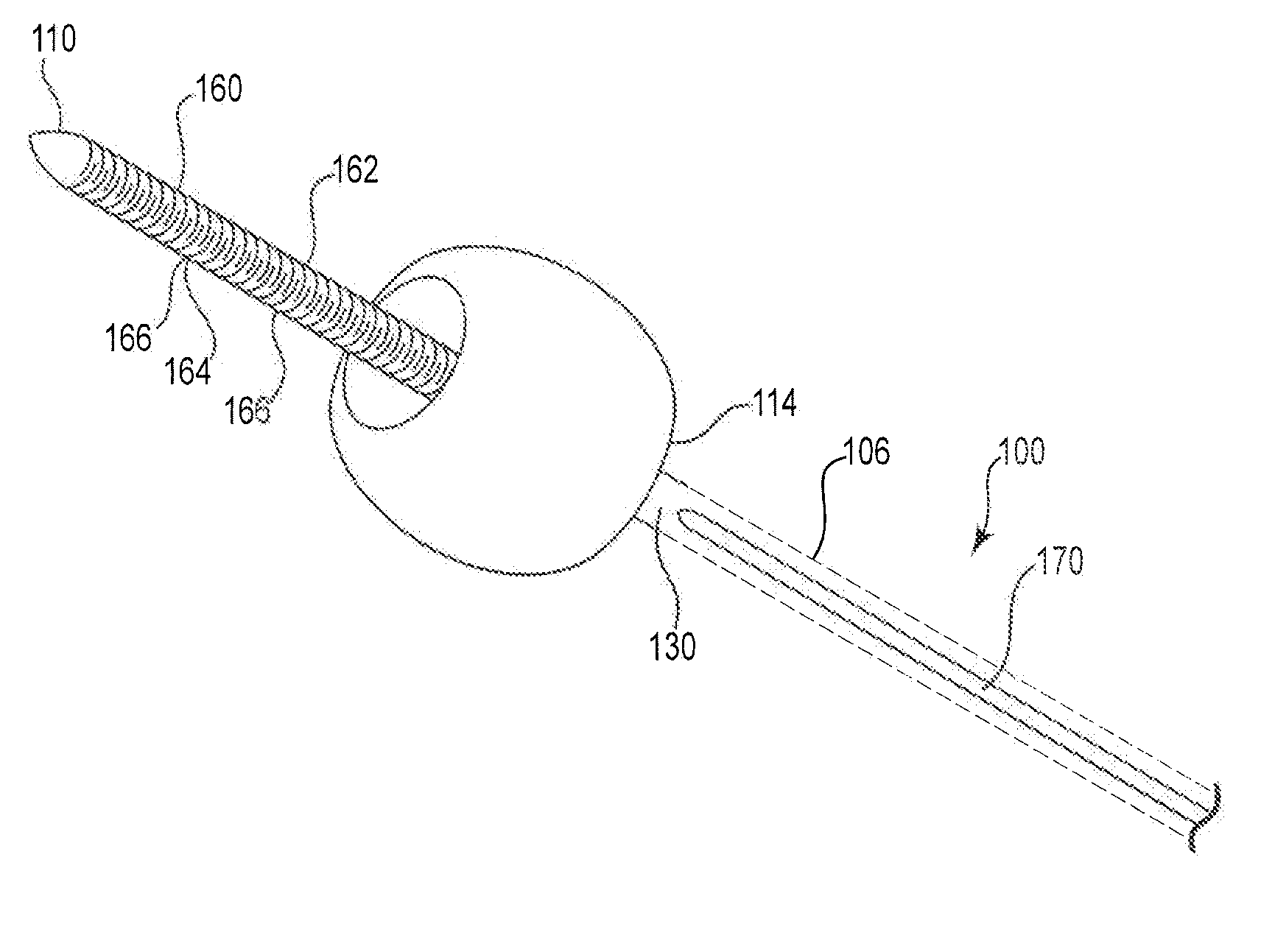 Anastomosis device and related methods