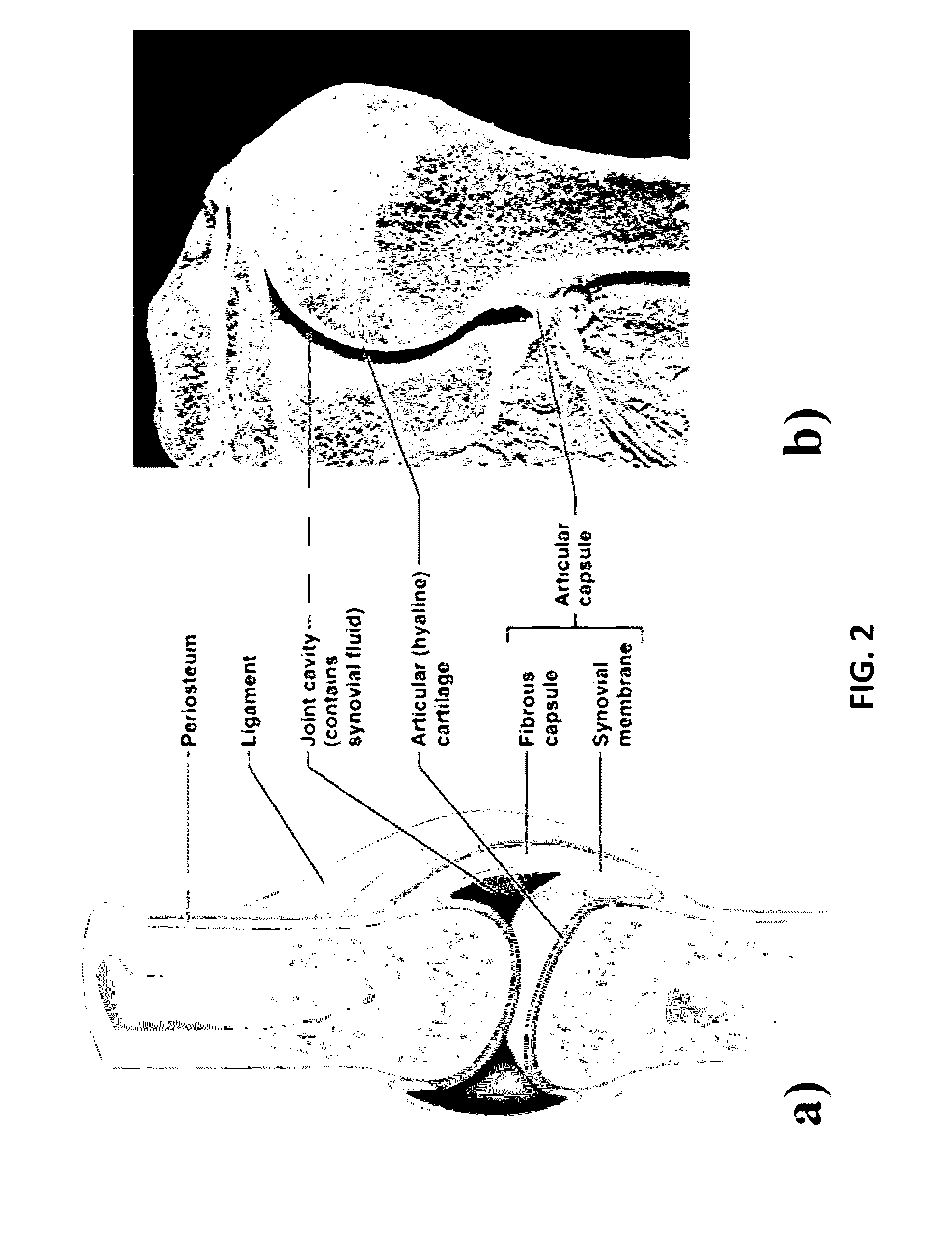 Orthopaedic joints providing enhanced lubricity