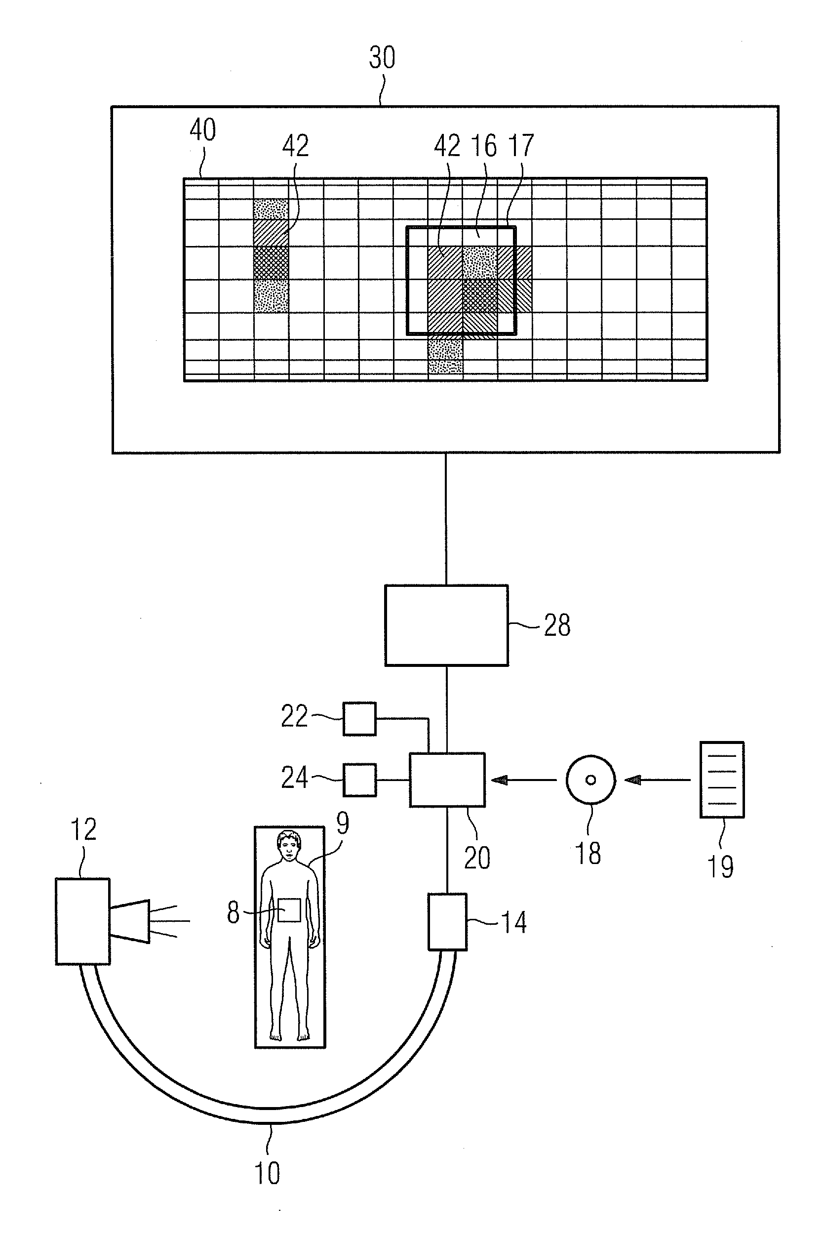 Method for visualizing a patient dose, computer program product and X-Ray apparatus