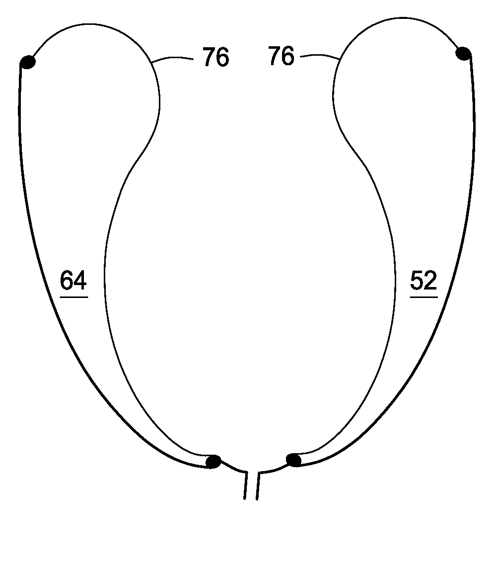 Device for the modulation of cardiac end diastolic volume