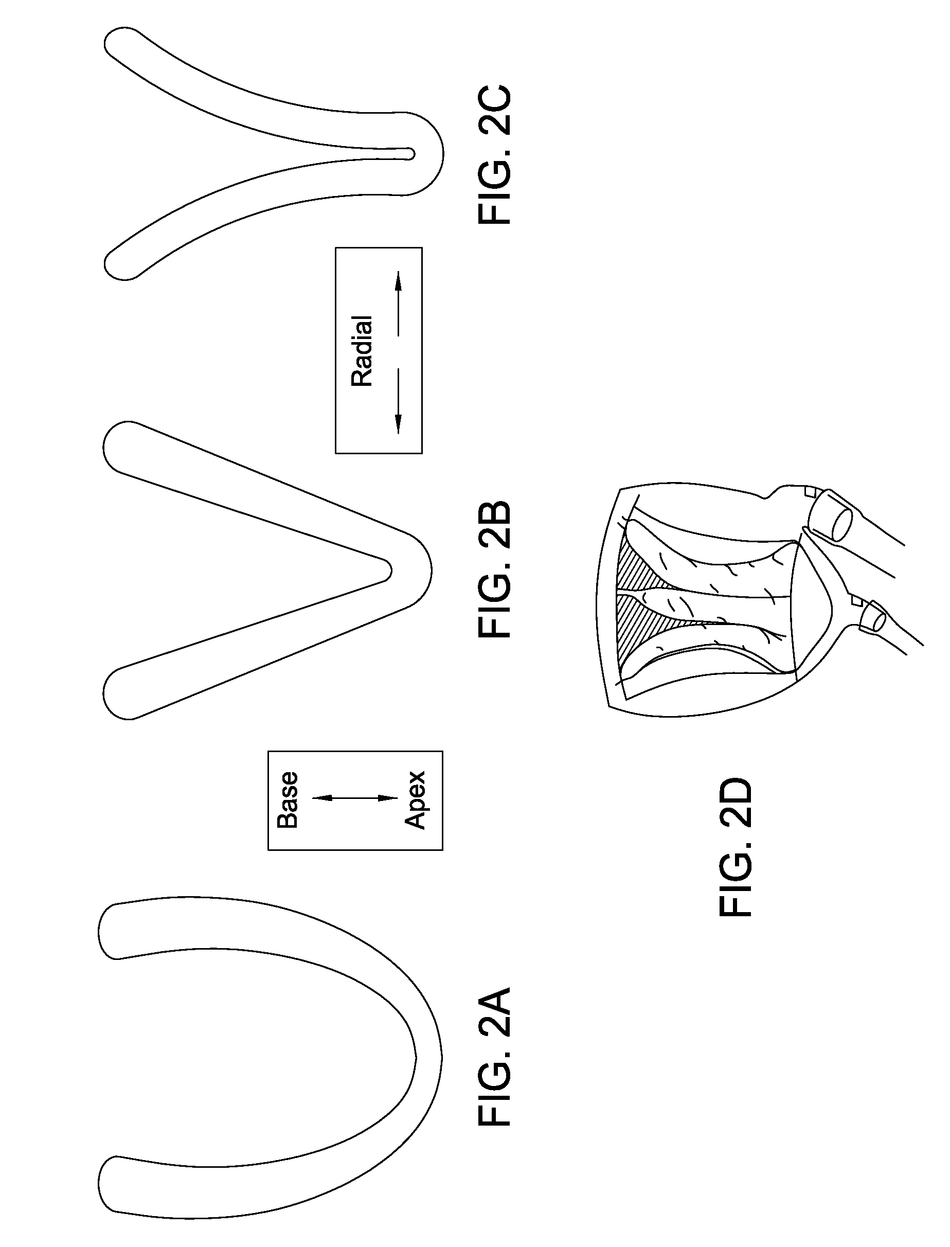 Device for the modulation of cardiac end diastolic volume