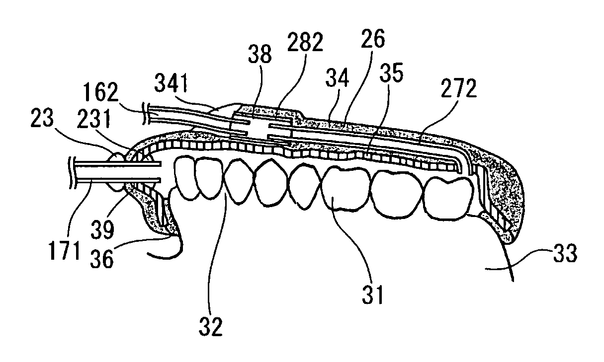 Dental system and method of producing the same