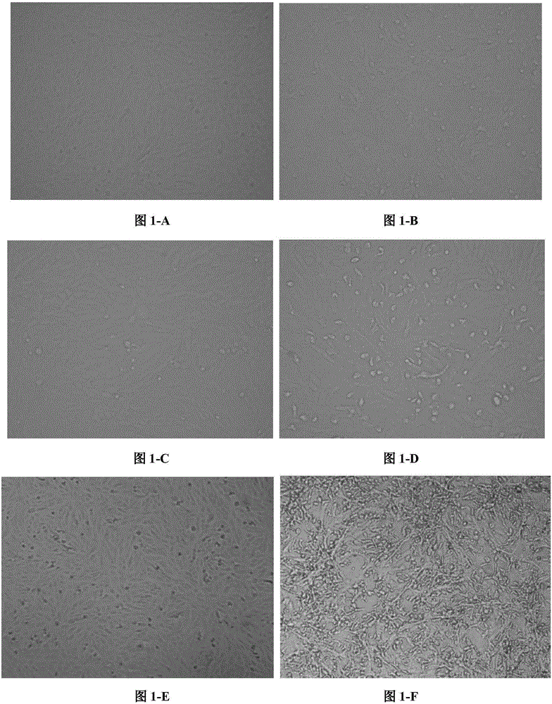 Porcine Epidemic Diarrhea Virus and application thereof